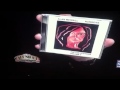 Alan Merrill interview, current projects, Joey Reynolds Show