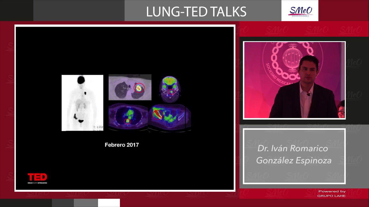 Ivan Romarico González Espinoza-5