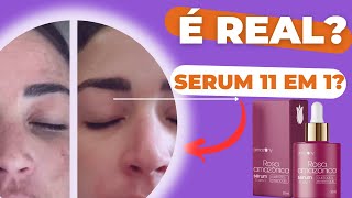 ROSA AMAZONICA É BOM?(( DEPOIMENTO )) ROSA AMAZONICA MOSQUETA - ROSA AMAZONICA SÉRUM -ROSA AMAZONICA