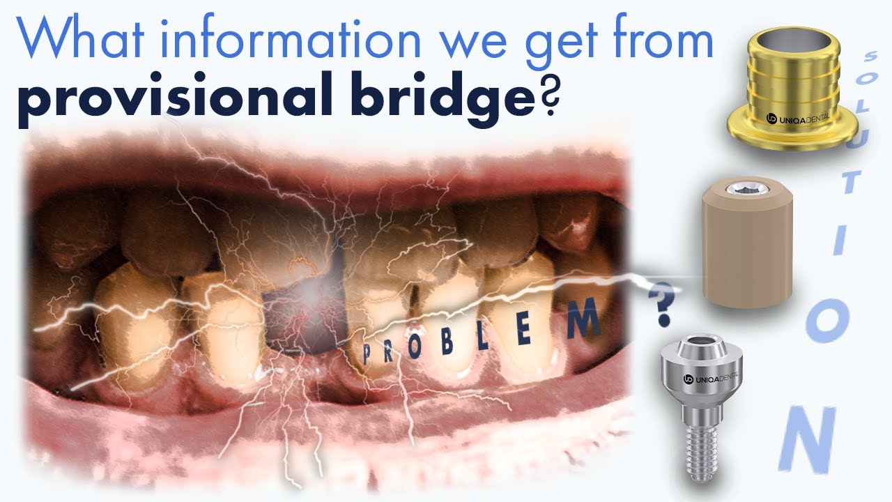 How to plan screw retained restoration | What information we get from provisional bridge