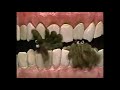 Sesame Street Germs Invade A Mouth