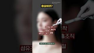 [ENG] 시술, 수술 부작용! 흉살 치료 주사, 아무거나 맞아도 될까요?