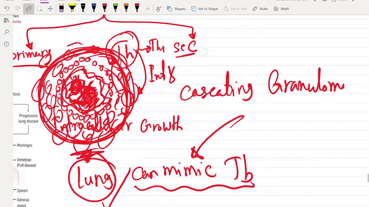 5. Pulmonology part 5 for USMLE Step 2 CK - (Free trial course in Description Below)