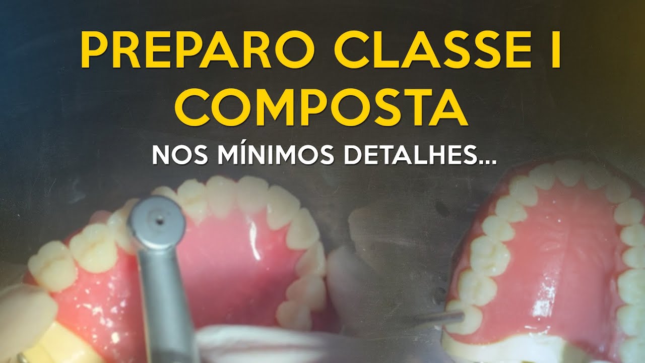 Preparo Classe I composta nos mínimos detalhes | DENTÍSTICA