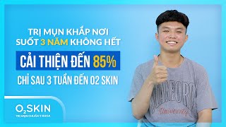 Thành Thái: Mụn lâu năm đã điều trị ngoài mong đợi