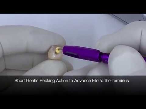 "C" Files and The EndoHandle