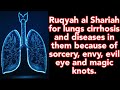 Ruqyah Shariah For Lungs Cirrhosis And Diseases In Them Due To Sorcery Envy Evil Eye And Magic Knots
