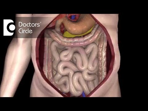 What is Hyperthermic Intraperitoneal Chemotherapy? -Dr. Somashekhar S P