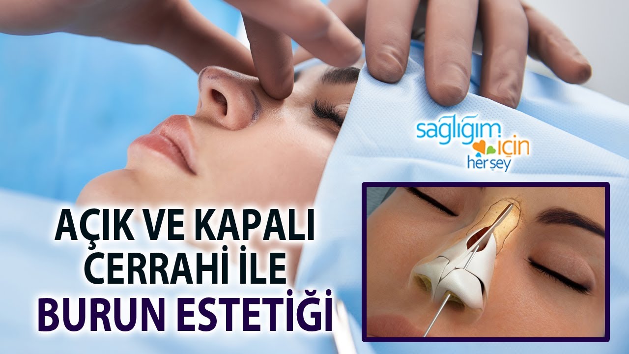 Burun Estetiğinde Açık ve Kapalı Cerrahi Arasındaki Farklar