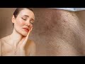 Full Brazilian Bikini Waxing Women Must Watch 2025 Brazilianwaxing