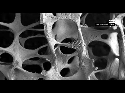 Articolazioni MRI foto Esercizi di yoga per aprire le articolazioni dellanca