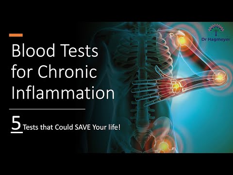 5 🩸Tests Best for  Chronic Inflammation- ⚠️5 Tests That Could Save Your Life