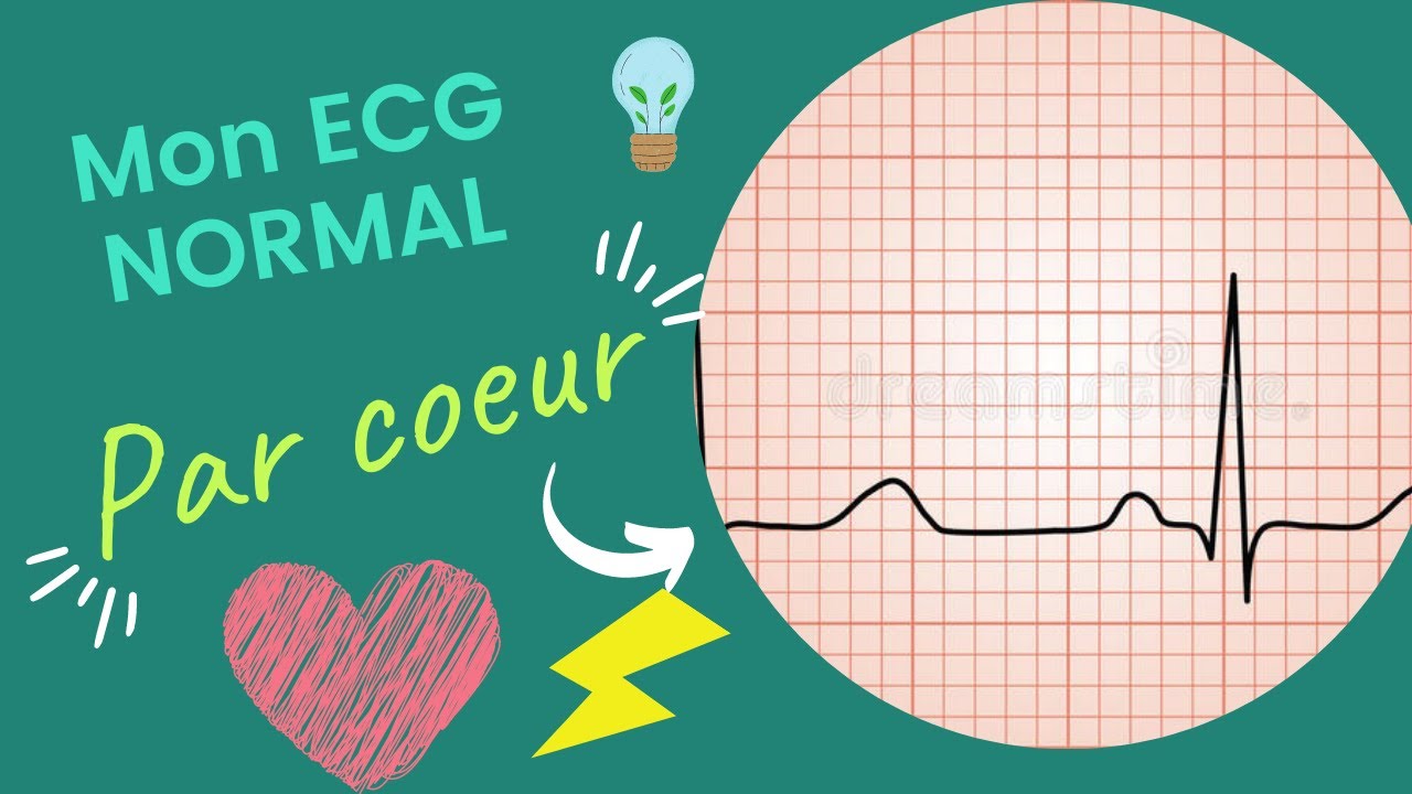 ECG normal: les MUST à connaitre!