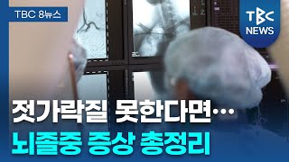[닥터리포트] 뇌졸중 증상 총정리..
