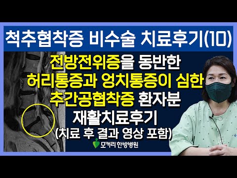 치료후기사진 입니다.