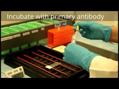 Immunohistochemistry - Procedure