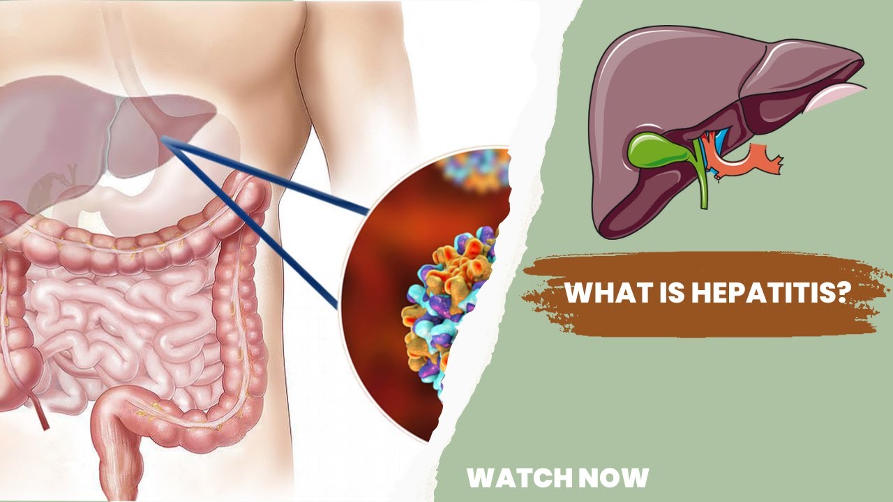 Viral hepatitis – types, clinical picture, diagnosis and treatment