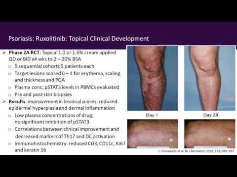 krém pikkelysömör antipsoriasis