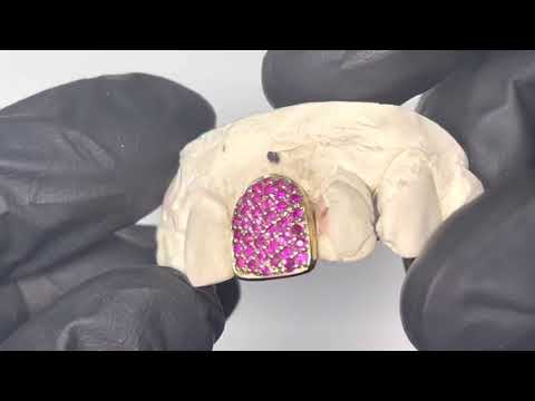 Single Tooth Grillz Iced Out w Hot Pink Sapphires (14K, Yellow Gold) | Luxe Grillz