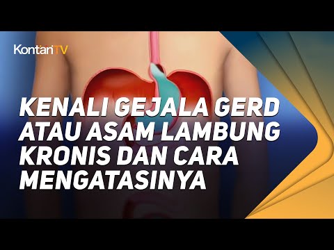 , title : 'Kenali Gejala GERD atau Asam Lambung Kronis dan Cara Mengatasinya'