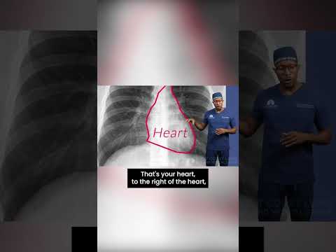 How to read a CHEST X-RAY, let's talk about it! #shorts #doctor #xray