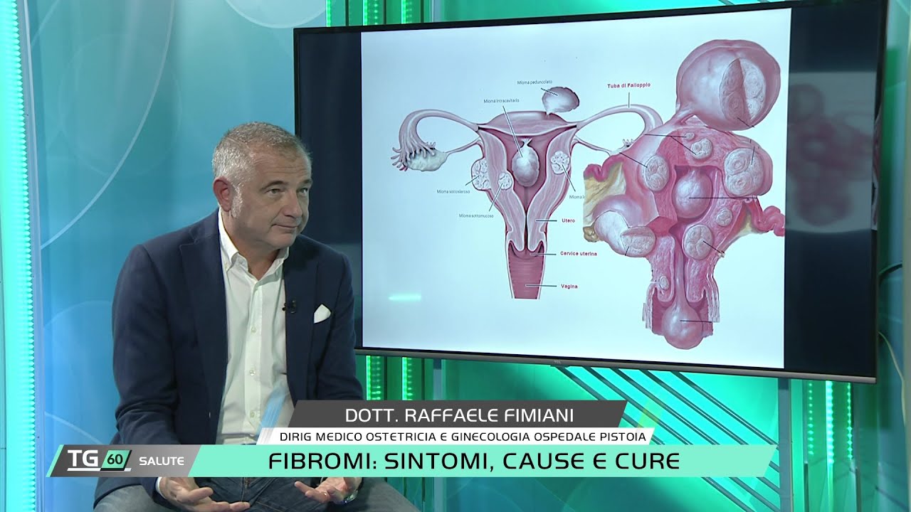 FIBROMI: SINTOMI, CAUSE E CURE.