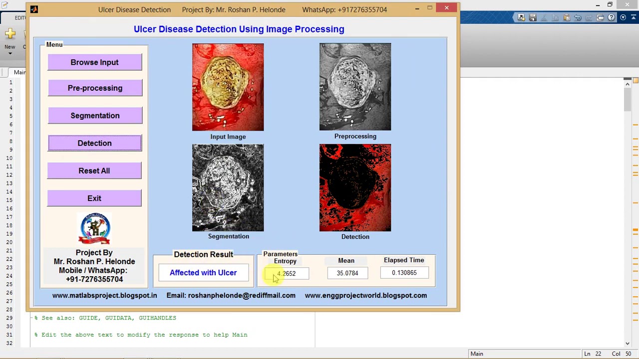 Matlab Code for Ulcer Detection Using Image Processing IEEE Based Project