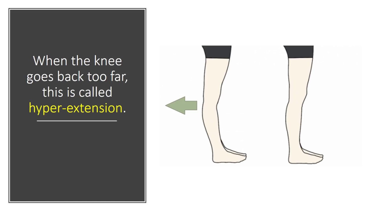 What Does It Mean When Your Knee Goes Back Too Far? Meet the PCL