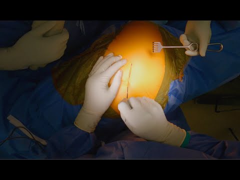 Gelenkzentrum Bergisch Land - Praxis Dr. med. Henning Quitmann YouTube-Vdeominiatur 1