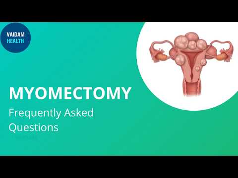 Myomectomy - Frequently Asked Questions