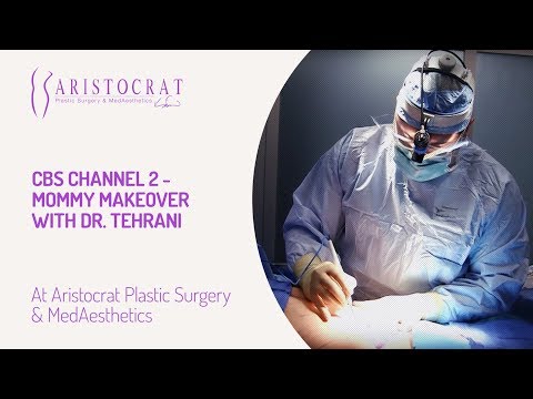 CBS Channel 2 - Mommy Makeover with Dr. Tehrani