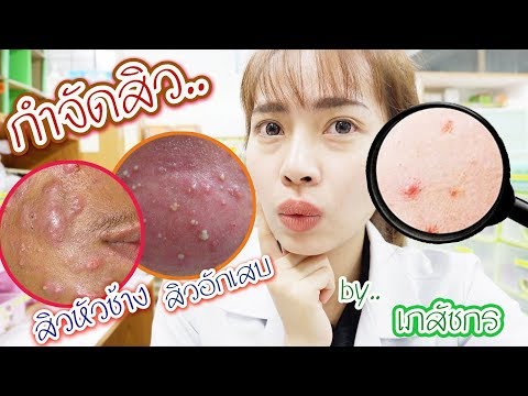 รักษาความอ่อนแอในความคิดเห็นของผู้ชาย เกาลัดม้าแรง