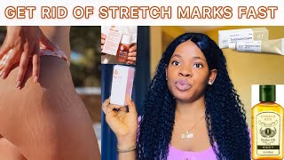 HOW TO GET RID OF STRETCHMARKS: Snake Oil For Stretchmarks + Prevent Pregnancy Stretch marks
