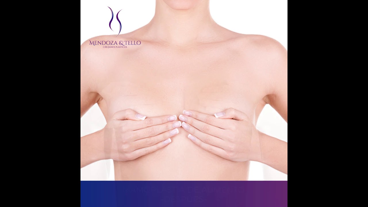 Alexander Mendoza-113