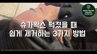슈가 왁싱 떡졌을 때 쉽게 제거하는 3가지 방법
