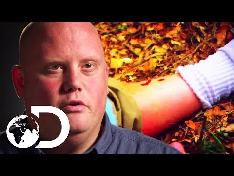 Deadly Rattlesnake Bite Nearly Claims A Man's Life | I'm Alive