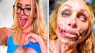 15 DESASTRES EM CIRURGIAS PLÁSTICAS DE FAMOSOS