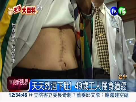 天天灌烈酒! 工人罹患食道癌