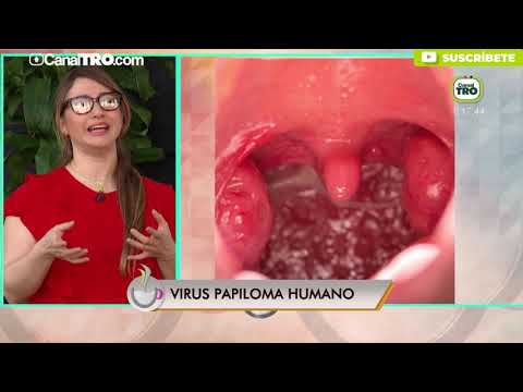 Papillomavirus que faire