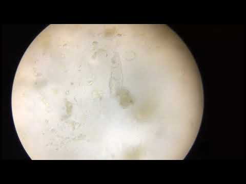 Rotifer and Detritus Worm under the microscope 400x