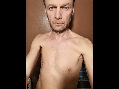 Post cu apă - Mărturie 40 de zile de post cu apa terapeutic - Vasile Nemes