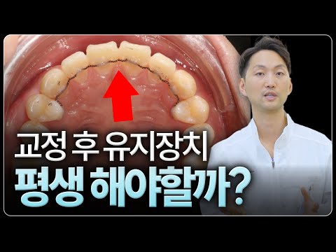 교정 유지장치 콘텐츠