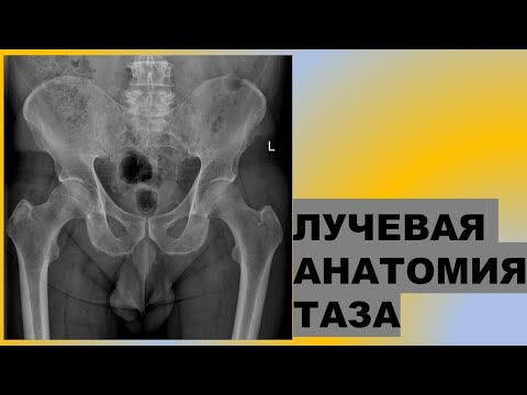 Причины болей в суставах у мужчин Больничный лист при бурсите локтевого сустава