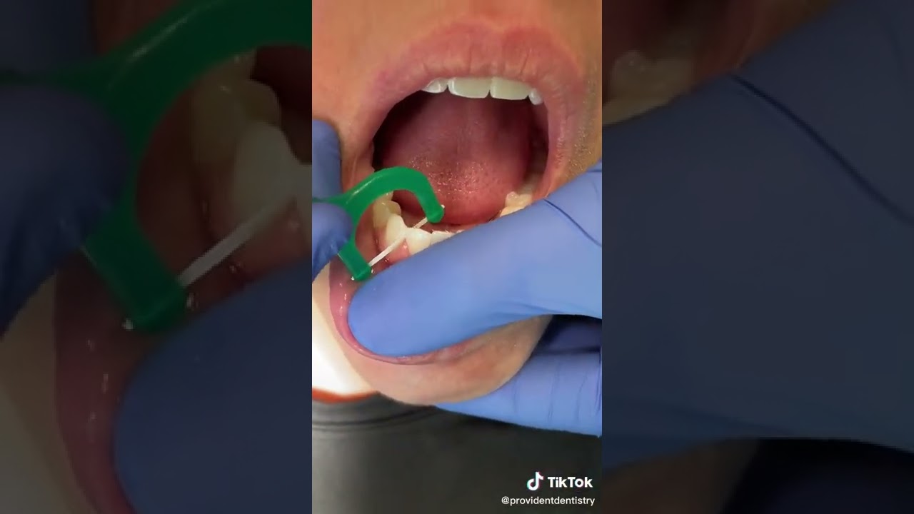 #Howto Use Floss Picks Properly! #shorts 🪥