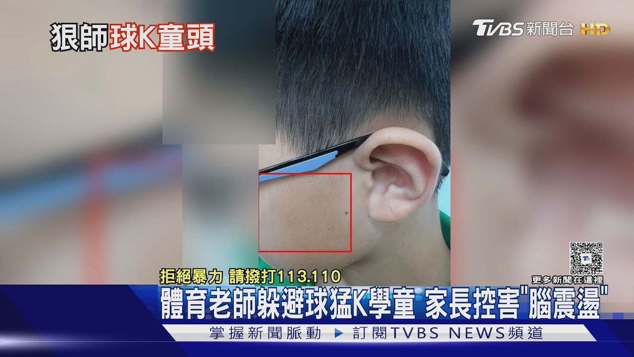 體育課球砸臉「國小生腦震盪」 家長控體育師霸凌