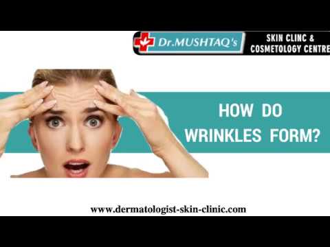 Botox Forehead Lines Treatment, For For Removing Forehead Lines