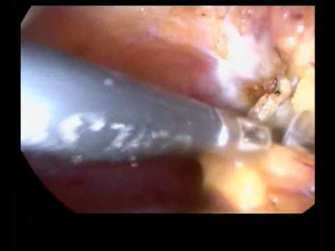 Rajani Hospital Video 10