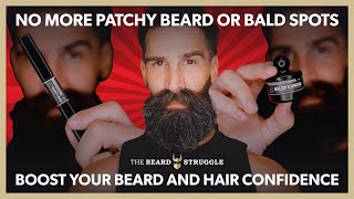 Thin Balding Hair - Patchy Beard - Bald Spots | Quick & Easy Fix 👉 Baldr