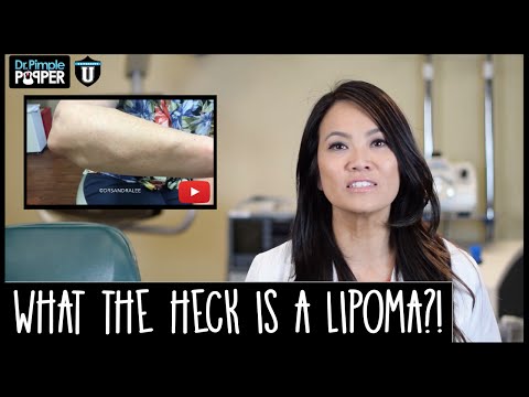 What are Lipomas anyway? - Up on Dr. Pimple Popper University!