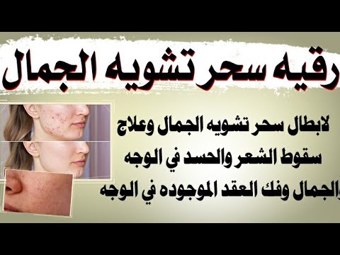 رقيه علاج سحر تشويه الجمال وسحر الصور وعلاج الحسد في الوجه والجمال و الشعر وفك عقد الوجه قويه جدا
